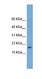 GSK3B Interacting Protein antibody, orb326135, Biorbyt, Western Blot image 