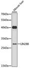 Lin-28 Homolog B antibody, LS-C748024, Lifespan Biosciences, Western Blot image 