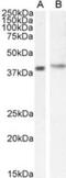 Cytohesin 1 Interacting Protein antibody, NB100-1002, Novus Biologicals, Western Blot image 
