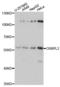 Oxysterol Binding Protein Like 2 antibody, A07543, Boster Biological Technology, Western Blot image 