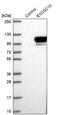 Exosome Component 10 antibody, PA5-55869, Invitrogen Antibodies, Western Blot image 