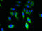 Transient Receptor Potential Cation Channel Subfamily M Member 8 antibody, LS-C371614, Lifespan Biosciences, Immunofluorescence image 