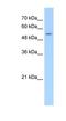 Solute Carrier Family 26 Member 8 antibody, NBP1-70717, Novus Biologicals, Western Blot image 