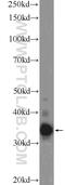 Testis Expressed 264, ER-Phagy Receptor antibody, 25858-1-AP, Proteintech Group, Western Blot image 