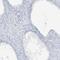 Scm Polycomb Group Protein Like 1 antibody, HPA035270, Atlas Antibodies, Immunohistochemistry paraffin image 