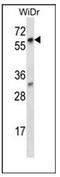 La Ribonucleoprotein Domain Family Member 7 antibody, AP52443PU-N, Origene, Western Blot image 