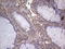 Nudix Hydrolase 12 antibody, LS-C798254, Lifespan Biosciences, Immunohistochemistry paraffin image 