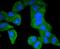 Platelet Derived Growth Factor Receptor Beta antibody, A00096Y740, Boster Biological Technology, Immunocytochemistry image 