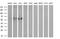 Cytochrome P450 Family 2 Subfamily A Member 6 antibody, MA5-25751, Invitrogen Antibodies, Western Blot image 