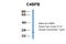 Complement Component 4 Binding Protein Beta antibody, 27-955, ProSci, Immunohistochemistry frozen image 