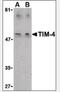 T Cell Immunoglobulin And Mucin Domain Containing 4 antibody, NBP1-03238, Novus Biologicals, Western Blot image 