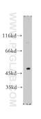 TNF Receptor Superfamily Member 10d antibody, 16781-1-AP, Proteintech Group, Western Blot image 