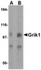 Glutamate receptor, ionotropic kainate 1 antibody, MBS151021, MyBioSource, Western Blot image 