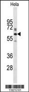 Glypican 1 antibody, MBS9211418, MyBioSource, Western Blot image 