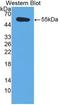 Tissue Factor Pathway Inhibitor antibody, LS-C663583, Lifespan Biosciences, Western Blot image 
