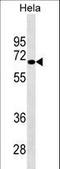 NUAK Family Kinase 2 antibody, LS-C163047, Lifespan Biosciences, Western Blot image 