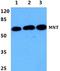 MAX Network Transcriptional Repressor antibody, A03357-1, Boster Biological Technology, Western Blot image 