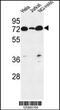 Phospholipid Phosphatase Related 4 antibody, MBS9214566, MyBioSource, Western Blot image 