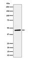 Pleckstrin Homology Domain Containing A1 antibody, M08988, Boster Biological Technology, Western Blot image 