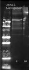 Alpha-2-Macroglobulin antibody, orb86641, Biorbyt, Western Blot image 