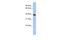 Tetraspanin 17 antibody, PA5-69207, Invitrogen Antibodies, Western Blot image 