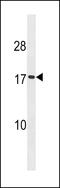 Signal peptidase complex catalytic subunit SEC11A antibody, 60-868, ProSci, Western Blot image 