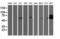 Ribosomal Protein S6 Kinase B1 antibody, M01475-3, Boster Biological Technology, Western Blot image 