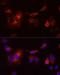 Cytochrome B-245 Beta Chain antibody, LS-C335167, Lifespan Biosciences, Immunofluorescence image 