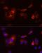 Cytochrome B-245 Beta Chain antibody, LS-C335167, Lifespan Biosciences, Immunofluorescence image 