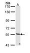 Serine/Threonine Kinase 32C antibody, PA5-29414, Invitrogen Antibodies, Western Blot image 