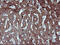 Matrix Metallopeptidase 13 antibody, M00420-1, Boster Biological Technology, Immunohistochemistry paraffin image 