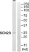 Sodium Voltage-Gated Channel Beta Subunit 2 antibody, abx014898, Abbexa, Western Blot image 