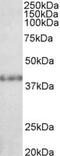 Suppressor Of Variegation 3-9 Homolog 2 antibody, MBS420623, MyBioSource, Western Blot image 