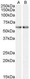 Smoothened, Frizzled Class Receptor antibody, MBS420043, MyBioSource, Western Blot image 
