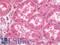 Jagged Canonical Notch Ligand 1 antibody, LS-B12144, Lifespan Biosciences, Immunohistochemistry paraffin image 