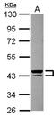Keratin 13 antibody, NBP2-16086, Novus Biologicals, Western Blot image 