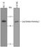 Lysyl Oxidase Like 2 antibody, PA5-47358, Invitrogen Antibodies, Western Blot image 