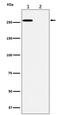 Acetyl-CoA Carboxylase Alpha antibody, P01802-1, Boster Biological Technology, Western Blot image 