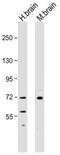 Neurofilament Light antibody, 13-0400, Invitrogen Antibodies, Western Blot image 
