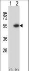 Dystrobrevin Binding Protein 1 antibody, LS-C167552, Lifespan Biosciences, Western Blot image 