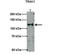 Trafficking Kinesin Protein 1 antibody, TA334986, Origene, Western Blot image 