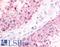 Purinergic Receptor P2Y1 antibody, LS-A3786, Lifespan Biosciences, Immunohistochemistry paraffin image 