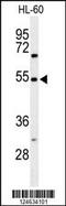 Gastrin Releasing Peptide Receptor antibody, MBS9213864, MyBioSource, Western Blot image 