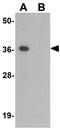Transmembrane protein 106A antibody, GTX32066, GeneTex, Western Blot image 