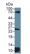 Major Histocompatibility Complex, Class II, DR Alpha antibody, LS-C301239, Lifespan Biosciences, Western Blot image 