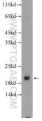 HRas Proto-Oncogene, GTPase antibody, 18295-1-AP, Proteintech Group, Western Blot image 
