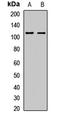 HECT And RLD Domain Containing E3 Ubiquitin Protein Ligase 3 antibody, LS-C667852, Lifespan Biosciences, Western Blot image 