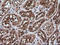 Rhotekin antibody, LS-C174147, Lifespan Biosciences, Immunohistochemistry paraffin image 