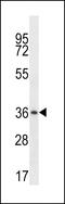 Mitochondrial E3 Ubiquitin Protein Ligase 1 antibody, LS-C164681, Lifespan Biosciences, Western Blot image 
