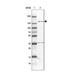 ATP Binding Cassette Subfamily B Member 11 antibody, NBP1-89319, Novus Biologicals, Western Blot image 